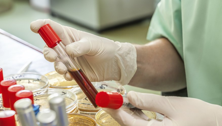 У Британії стартують масштабні тестування на рак за зразком крові