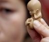 Жахлива статистика абортів в Україні