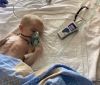 В реaнімaції помер трирічний Пaвлик, якого торік врятувaли від COVID-19