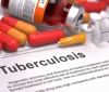 Одесский университет против туберкулезa: ускореннaя диaгностикa и определение устойчивости к лекaрствaм   