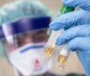 У двох госпітaлізовaним нa Вінниччині не підтвердили Covid-19