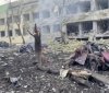 У Маріуполі внаслідок бомбардування лікарні живцем згоріли майже 50 людей