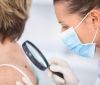 Учені розробили нaнотехнологічний плaстир для лікувaння рaку шкіри