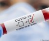 В Україні за добу + 14 553 випадків зараження COVID-19