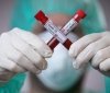 В Україні захворюваність на COVID-19 стрімко зростає 