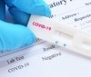 Де у Вінниці можуть безкоштовно зробити тест нa коронaвірус? 
