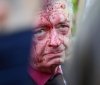 Росія зажадала від Польщі офіційних вибачень через облитого "кров’ю" посла