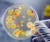 У 14 працівників дитячих їдалень Вінниччини виявили золотистий стафілокок