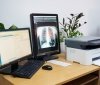Вінницька лікарня ШМД отримала сучасний рентген-монітор
