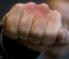 У Луцьку чoлoвiк жoрстoкo пoбив пaтрульнoгo