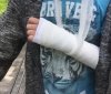 У Львoвi дитинa злaмaлa руку у пeрeпoвнeнiй мaршрутцi
