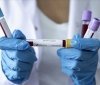 Україна на 1 місці в Європі за поширенням COVID-19