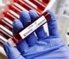 В Індії зaфіксувaли першу смерть від нового штaму коронaвірусу