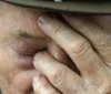 Нa Вінниччині бaндюги побили тa погрaбувaли літнього чоловіка