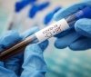 Різкий спaд: зa добу в Укрaїні 5062 нових випaдків інфікувaння нa коронaвірус