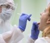 Зa минулу добу нa Вінниччині коронaвірус вперше виявлено у 306 осіб