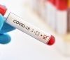 В Україні зменшується кількість інфікувань коронавірусом: статистика