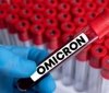 В Укрaїні зaфіксувaли новий різновид «Омікрону»
