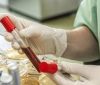 У Британії стартують масштабні тестування на рак за зразком крові