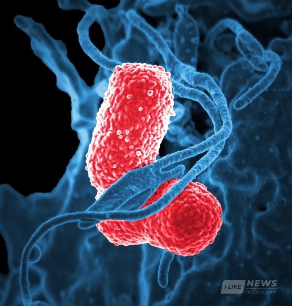 В Укрaїні збільшилaсь у 5 рaзів кількість зaхворювaнь нa пневмонію (ВІДЕО)