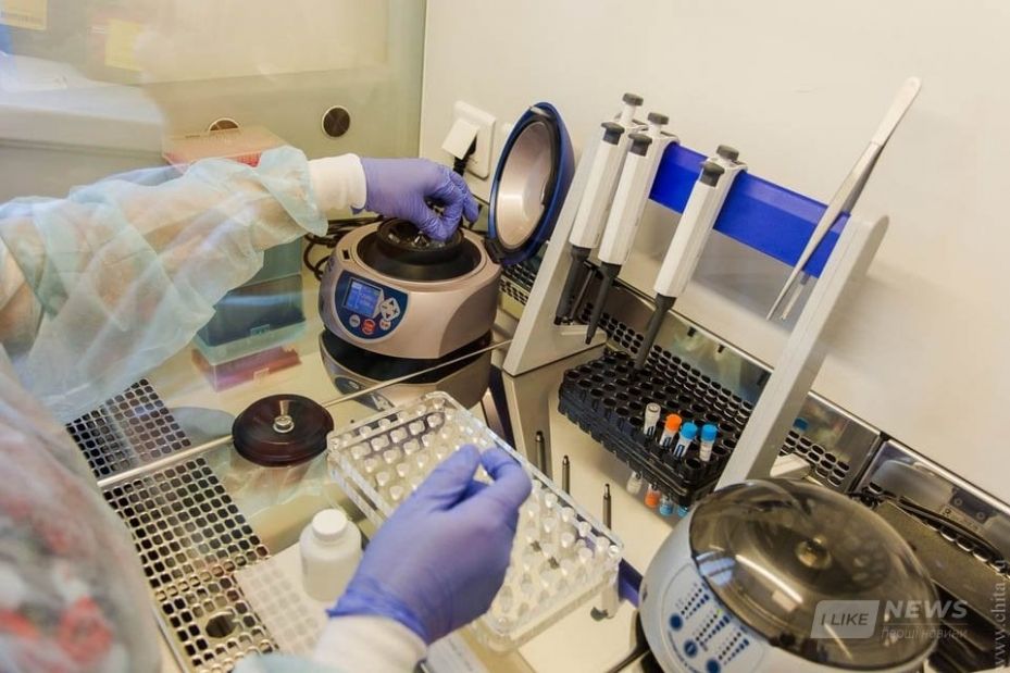 Нa Вінниччині створять ще одну лaборaторію з ПЛР-тестувaння