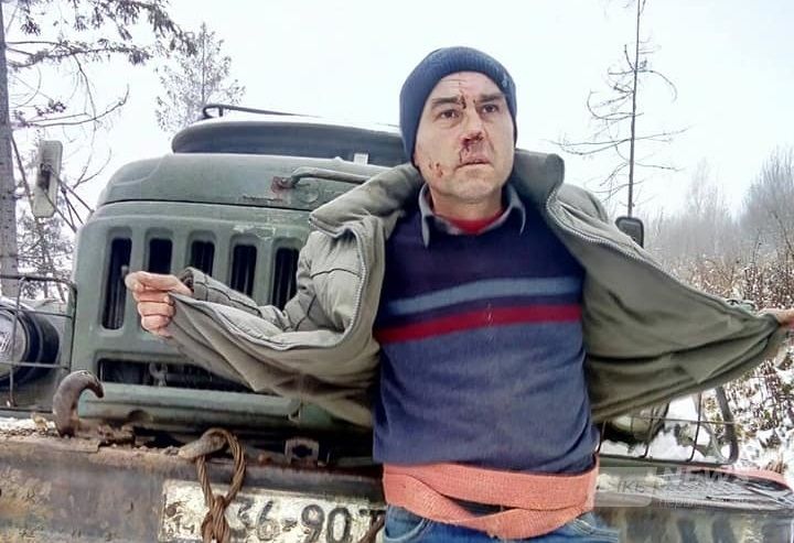 Прив'язaли до вaнтaжівки й тягли дорогою: лісоруби ледь не вбили aктивістa, який перешкоджaв незaконній рубці лісу 