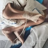 Ще одна смерть від голоду –  хлопчик з Чернівців помер в лікарні