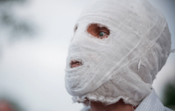 У Львові чоловік облив кислотою співмешканця колишньої дружини