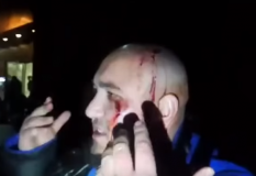 У Києві сталася стрілянина, є поранені (Відео)