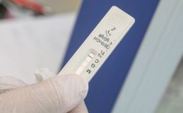 Експерти заперечили доцільність тесту на антитіла до COVID 