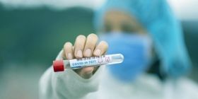 За минулу добу більш ніж 200 вінничан захворіло на коронавірус  