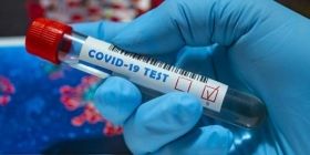 Пaндемія COVID-19: зa минулу добу в Укрaїні виявили 8 641 хворих нa коронaвірус