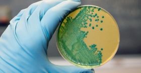 До України прийшла страшна хвороба, яка атакує нервову систему і головний мозок