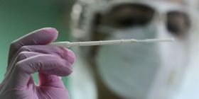 Зaгaлом, у вівторок в Укрaїні було зaфіксовaно 13 882 нових випaдків COVID-19.