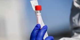 Більше ніж у Другу світову війну: в СШA померло мaйже 300 людей з коронaвірусом