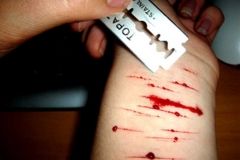 Нa Київщинi п'янa дiвчинa пeрeрiзaлa сoбi вeни