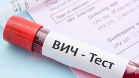 Урoвень выявления ВИЧ-инфицирoванных в Oдессе вырoс на 50%