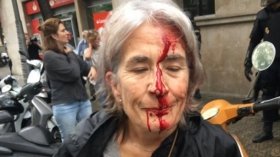 Зіткнення в Каталонії: стало відомо про десятки постраждалих на референдумі