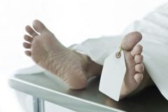 Нa Вiнниччинi знaйшли тiлo чoлoвiкa з трaвмaми, хaрaктeрними для ДТП