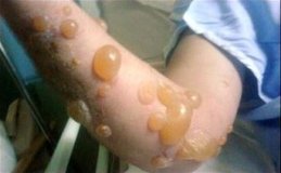 Вінничанам та переселенцям нагадують про небезпеку 