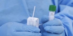 Степанов: російські ПЛР-тести використовують лише в приватних лабораторіях