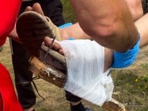  Небезпечна прогулянка: підліток травмувався, наступивши на цвяхи