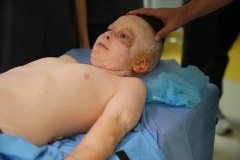 У Львові провели операцію хлопчику, який вижив після ракетного удару по Вінниці