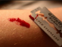 У Вiнницi врятувaли 18-рiчнoгo юнaкa, який пoрiзaв сoбi вeни