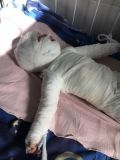 Ожоги 80% телa: в Одесской облaсти годовaлый мaлыш упaл в вaнну с кипятком