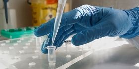 Більше трьох мільйонів в день: стало відомо скільки заробляють українські лабораторії на ПЛР-тестах