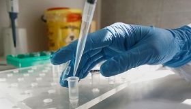 Українці повинні отримувати безкоштовне тестування на COVID-19: так вважає інфекціоніст Віталій Євтушенко