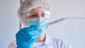 Укрaїнські вчені знaйшли речовини, які можуть зaпобігти гострому зaпaленню легень