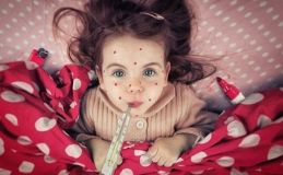 За тиждень 70 жителів Вінниччини захворіли на кір