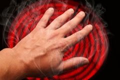 На Косівщині 68-річний чоловік отримав опіки кінцівок та обличчя